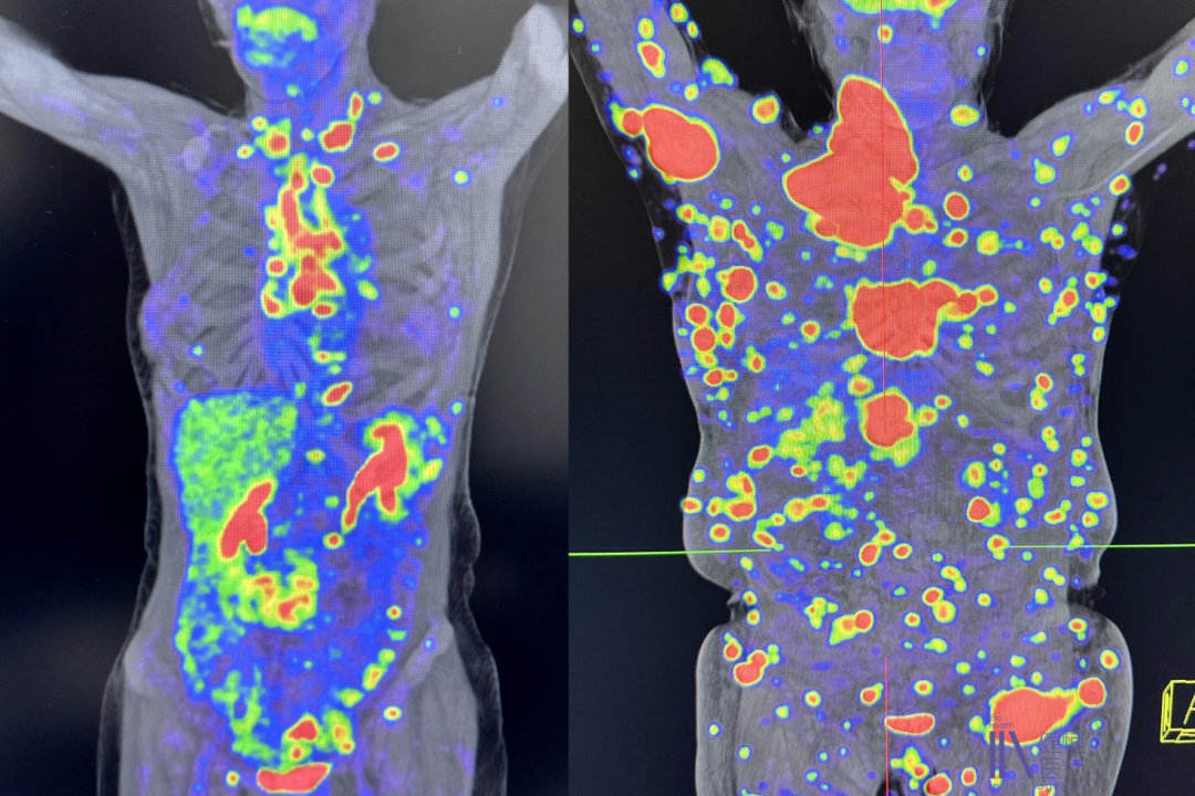 /uploads/image/2025/11/20/2500000194.png 2500000194.png